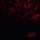 OSI: Blood (2CD)